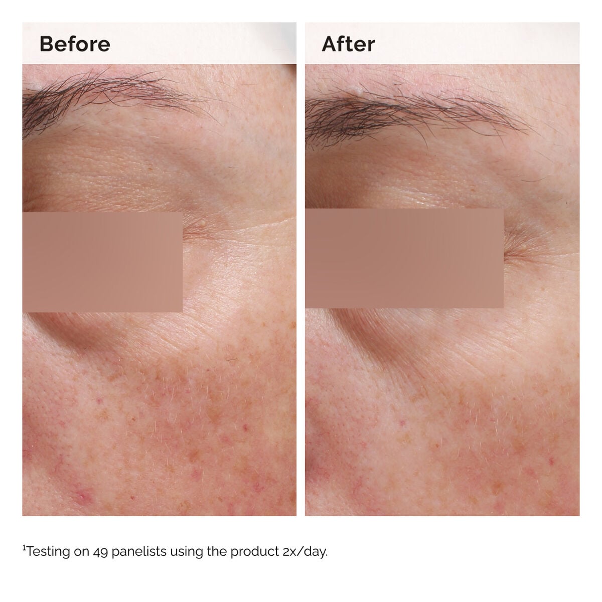 niacinamide-5-face-and-body-emulsion-c4 2024-08-23-ORD-Nia-5pct-Face-Body-B-A-Elasticity-Global-02-1x1.jpg