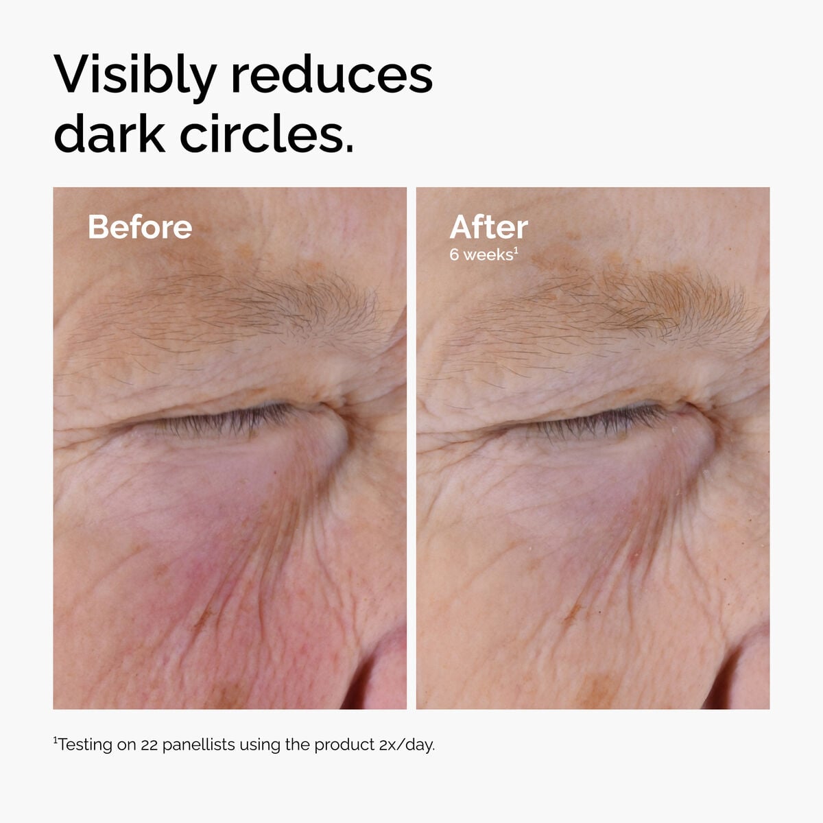 caffeine-solution-5-egcg-eye-serum-g2 ord-caffeine-solution-egcg-dark-circles-before-after.jpg