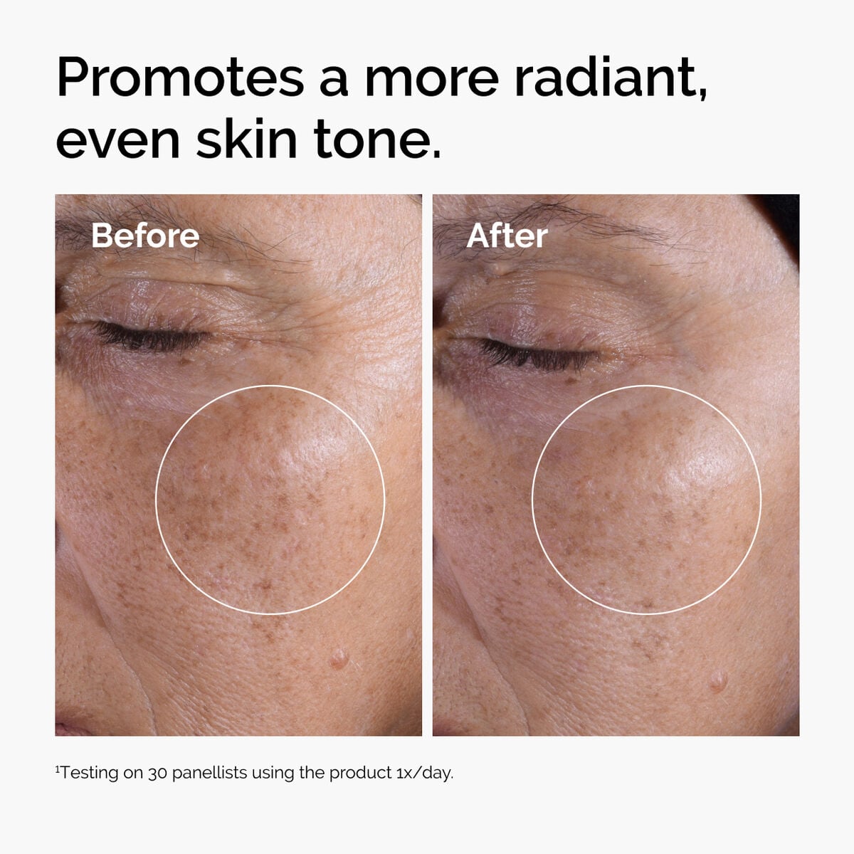 glycolic-acid-7-exfoliating-toner-q7 ord-glycolic-before-after-radiance.jpg
