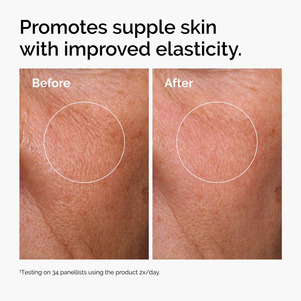 hyaluronic-acid-2-b5-with-ceramides-v7 ord-hyaluronic-acid-2pct-b5-hydrating-serum-before-after-elasticity.jpg