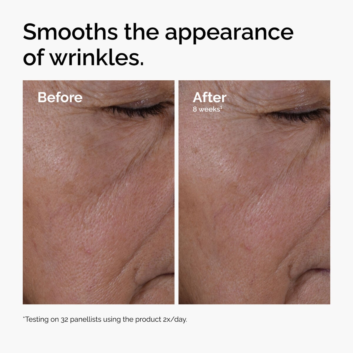 multi-peptide-ha-serum-m8 ord-multi-peptide-ha-serum-wrinkles-before-after.jpg