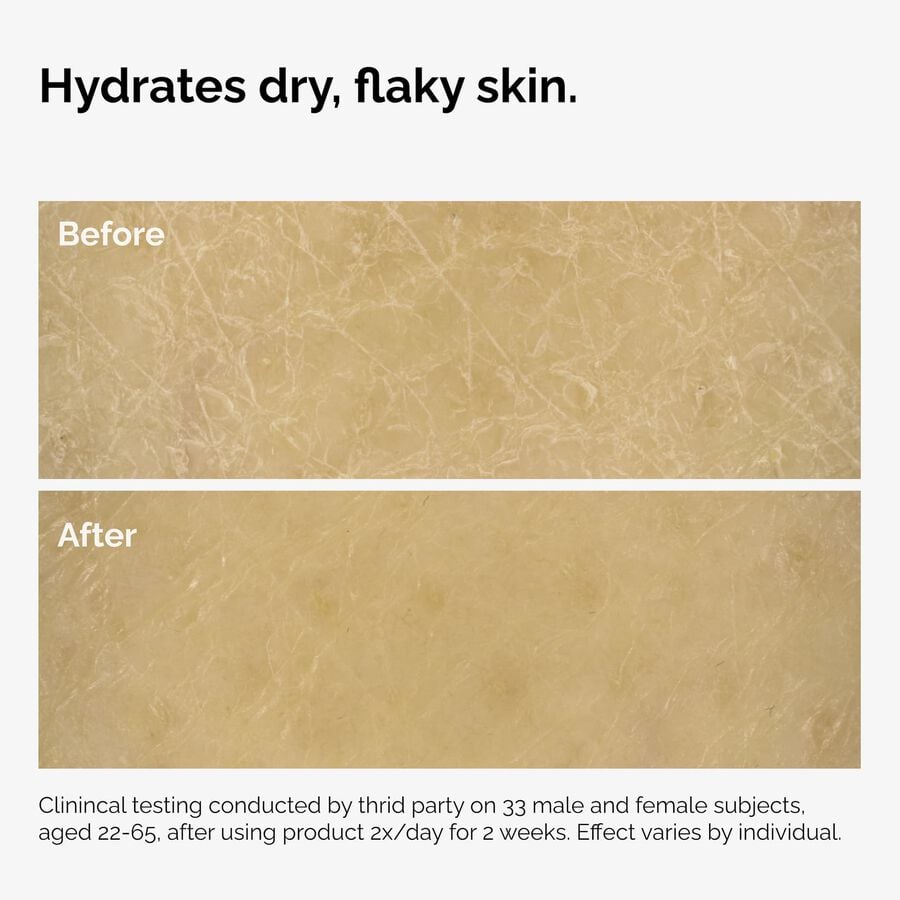 the-body-care-collection-k0 ord-natural-moisturizing-factors-inulin-body-before-after-graphic-02.jpg