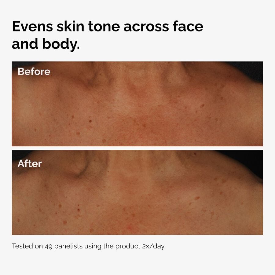 the-body-care-collection-k0 ord-niacinamide-face-body-serum-before-after-even-tone-graphic.jpg
