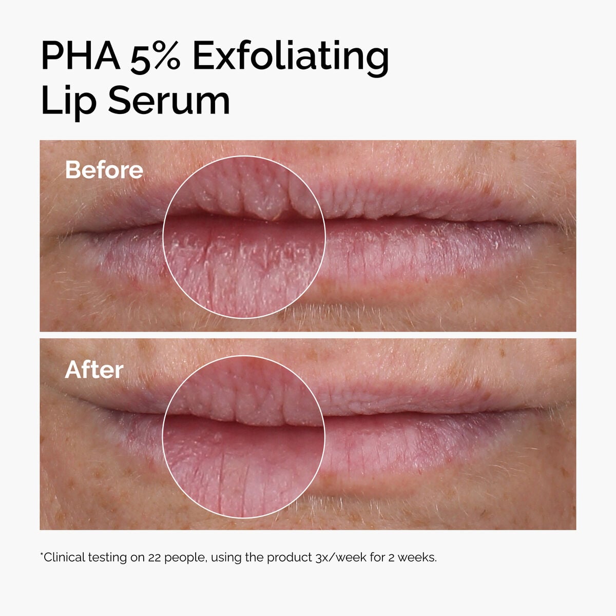 pha-5-exfoliating-lip-serum-i8 ord-pha-5pct-lip-exfoliating-serum-before-after.jpg