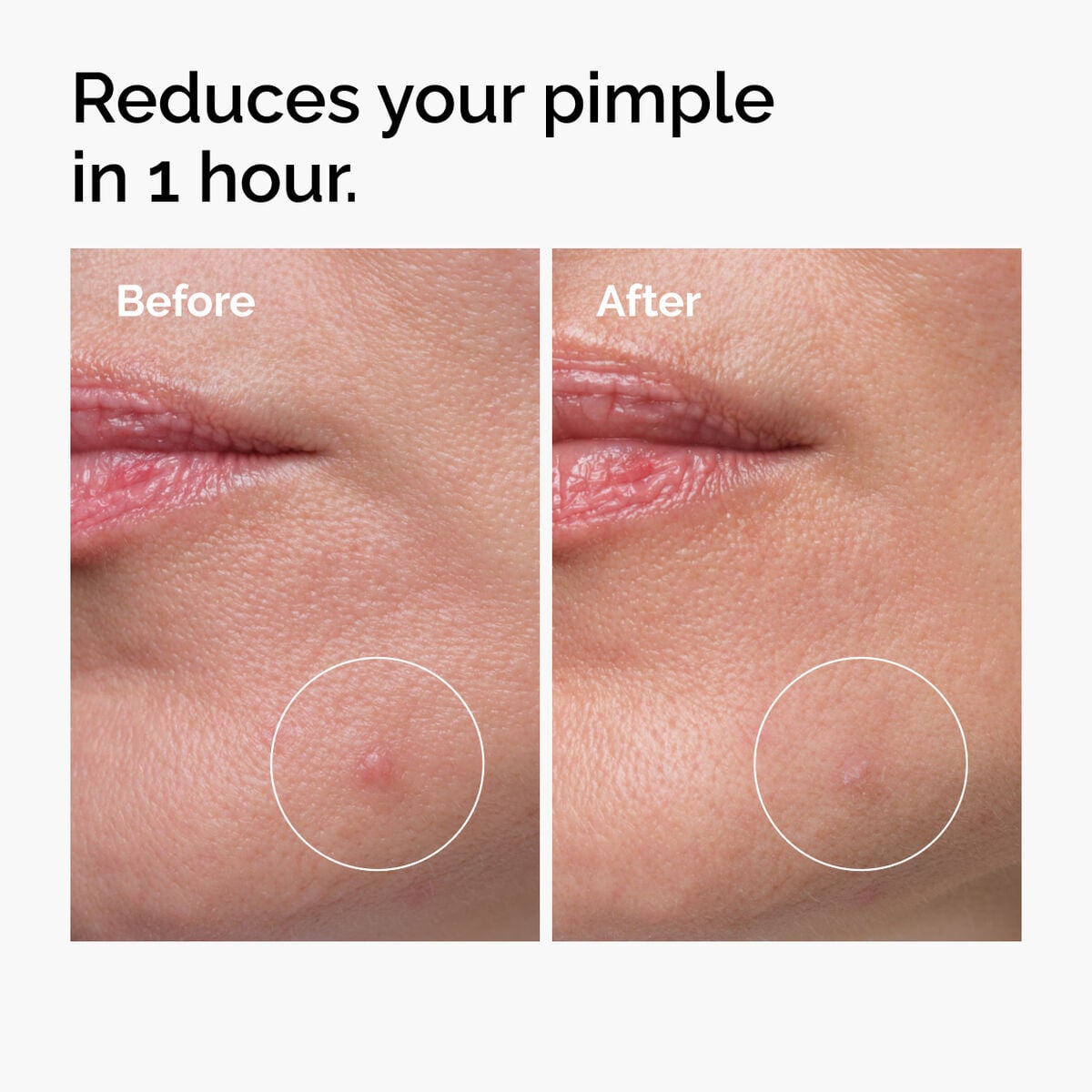 sulfur-10-powder-to-cream-concentrate-r9 ord-sulfur-10pct-powder-to-cream-concentrate-before-after-NA.jpg